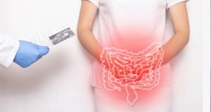 Cáncer de colon: especialistas sugieren actualizar las Guías Clínicas Ges